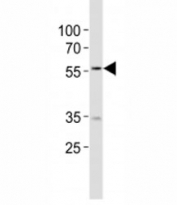 Western blot analysis of lysate from MCF-7 cell line using NAMPT antibody diluted at 1:1000. Expected molecular weight ~56 kDa.
