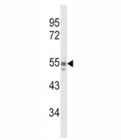 Western blot analysis of NAMPT antibody and A375 lysate. Expected molecular weight ~56 kDa.