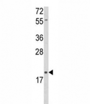 Western blot analysis of DLK2 antibody and HL-60 lysate. Predicted molecular weight: 40/21 kDa (isoform 1/2).