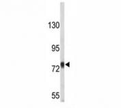 Western blot analysis of Amyloid beta precusor protein antibody in T47D lysate. Predicted molecular weight 79~120kDa depending on glycosylation level.