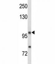 Western blot analysis of NRP1 antibody and MDA-MB435 lysate