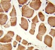 IHC analysis of FFPE human skeletal muscle stained with NRP1 antibody