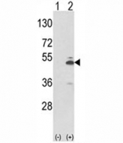 Western blot analysis of PKM2 antibody and 293 cell lysate (2 ug/lane) either nontransfected (Lane 1) or transiently transfected with the PKM2 gene (2). Predicted molecular weight ~58 KDa.