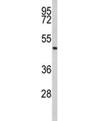 Western blot analysis of Acrosin antibody and human Jurkat lysate. Predicted molecular weight ~46 kDa.~