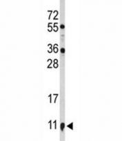 Western blot analysis of S100A10 antibody and NCI-H460 lysate.