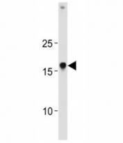 HMGA1 antibody western blot analysis in K562 lysate. Predicted molecular weight: ~12kDa.