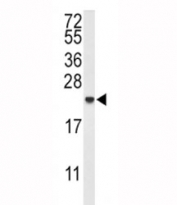 Western blot analysis of IL-10 antibody and MDA-MB435 lysate. Predicted molecular weight ~20 kDa.
