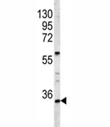 Western blot analysis of HOXA9 antibody and A2058 lysate. Predicted molecular weight ~30 kDa.~