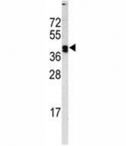 Western blot analysis of LOX antibody and MDA-MB468 lysate. Expected molecular weight: ~47 kDa (unprocessed/unmodified), ~50 kDa (glycosylated), ~32 kDa (processed form).