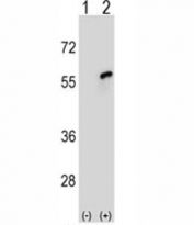 Western blot analysis of CDC20 antibody and 293 cell lysate either nontransfected (Lane 1) or transiently transfected (2) with the CDC20 gene.