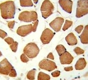 IHC analysis of FFPE human skeletal muscle stained with ANGPTL4 antibody