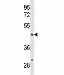 Western blot analysis of ANGPTL4 antibody and mouse liver tissue lysate.