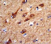 IHC analysis of FFPE human brain tissue stained with ACCN1 antibody