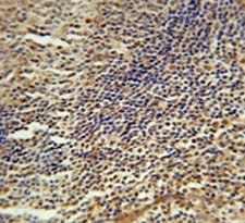 MEF2A antibody immunohistochemistry analysis in formalin fixed and paraffin embedded human tonsil tissue.