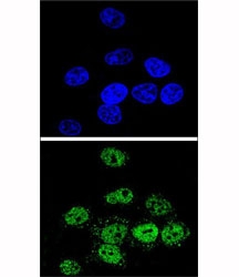 Confocal immunofluorescent analysis of MEF2A antibody with HeLa cells followed by Alexa Fluor 488-conjugated goat anti-rabbit lgG (green). DAPI was used as a nuclear counterstain (blue).