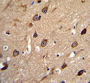 IHC analysis of FFPE human brain tissue stained with ASIC1 antibody
