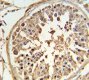 ABCF1 antibody IHC analysis in formalin fixed and paraffin embedded human testis tissue.