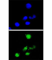 Confocal immunofluorescent analysis of p21 antibody with HepG2 cells followed by Alexa Fluor 488-conjugated goat anti-rabbit lgG (green). DAPI was used as a nuclear counterstain (b