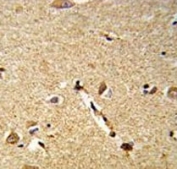 IHC analysis of FFPE human brain tissue stained with DLL3 antibody