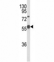 Western blot analysis of DLL3 antibody and A375 lysate. Predicted molecular weight: ~65 kDa.