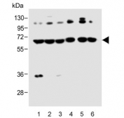 Western blot testing of human 1) A375, 2) U-251 MG, 3) NCI-H1299, 4) brain, 5) mouse brain and 6) rat brain lysate with DLL3 antibody. Predicted molecular weight: ~65 kDa.