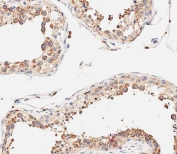 IHC staining of FFPE human testis with DLL3 antibody. HIER: boil tissue sections in pH 9 EDTA for 20 min and allow to cool before testing.