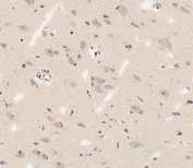 IHC staining of FFPE human brain with DLL3 antibody. HIER: boil tissue sections in pH 9 EDTA for 20 min and allow to cool before testing.