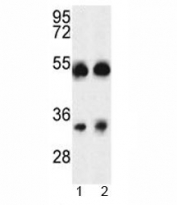 Western blot analysis of ORAI1 antibody and A375 cell line and mouse testis tissue lysate. Predicted molecular weight ~33kDa/45~50kDa (unmodified/glycosylated)