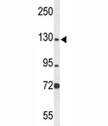 Western blot analysis of MCM2 antibody and HL-60 lysate