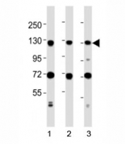 Western blot testing of MCM2 antibody at 1:2000 dilution. Lane 1: Jurkat lysate; 2: MCF-7 lysate; 3: NIH3T3 lysate; Predicted molecular weight : 102 kDa.
