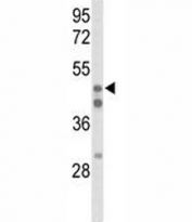 Western blot analysis of HNF4A antibody and 293 lysate. Predicted molecular weight ~50 kDa.