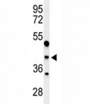 Western blot analysis of MAFA antibody and WiDr lysate. Predicted molecular weight ~37 kDa.