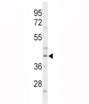 Western blot analysis of CEBPA antibody and mouse liver tissue lysate.