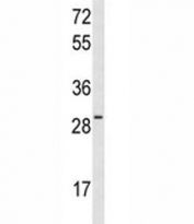 Western blot analysis of HES6 antibody and MCF-7 lysate.