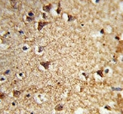 IHC analysis of FFPE human brain tissue stained with EIF2A antibody
