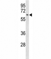 Western blot analysis of EIF2A antibody and Ramos lysate. Predicted molecular weight: 62, 58, 41 kDa.