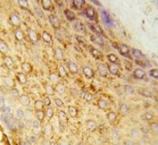 IHC analysis of FFPE human skin tissue stained with LDHA antibody