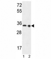 LDHA antibody western blot analysis in 1) Ramos and 2) A375 lysate. Predicted molecular weight ~36kDa.