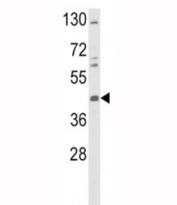 Western blot analysis of TAT antibody and K562 lysate. Expected molecular weight 45-50 kDa.