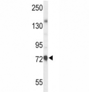 Western blot analysis of ChAT antibody and mouse liver tissue lysate. Predicted molecular weight ~83/74 kDa (isoforms M/S).