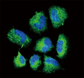 Confocal immunofluorescent analysis of CHAT antibody with NCI-H460 cells followed by Alexa Fluor 488-conjugated goat anti-rabbit lgG (green). DAPI was used as a nuclear counterstain (blue).
