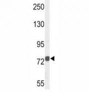 Western blot analysis of ChAT antibody and NCI-H460 lysate. Predicted molecular weight ~83/74 kDa (isoforms M/S).