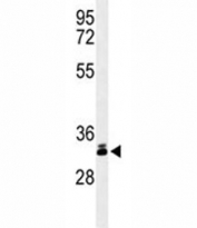 Western blot analysis of DKK-1 antibody and T47D lysate. Predicted molecular weight: 26-40 kDa depending on glycosylation level.