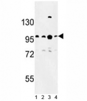 Western blot analysis of BCL11A antibody and 1) Jurkat, 2) Ramos, 3) 293 and 4)NCI-H460 lysate.