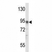 Western blot analysis of IL17RD antibody and MDA-MB231 lysate.