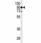 Western blot analysis of TLR4 antibody and HL-60 lysate.