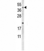 Western blot analysis of NEU1 antibody and MDA-MB231 lysate. Predicted molecular weight ~12 kDa.