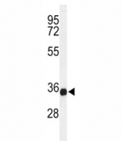 Western blot analysis of lysate from U-937 cell line using STING antibody at 1:1000. Predicted molecular weight ~42/35kDa, observed here at 35kDa.