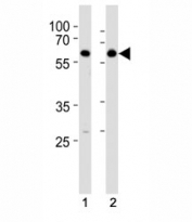 HDAC2 antibody western blot analysis in SH-SY5Y lysate. Predicted molecular weight: 55-60 kDa.