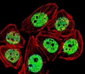 Fluorescent confocal image of A549 cells stained with FOXG1 antibody. Alexa Fluor 488 secondary was used (green). Cytoplasmic actin was counterstained with Alexa Fluor 555 (red) conjugated Phalloidin. FOXG1 immunoreactivity is localized to the nucleus.